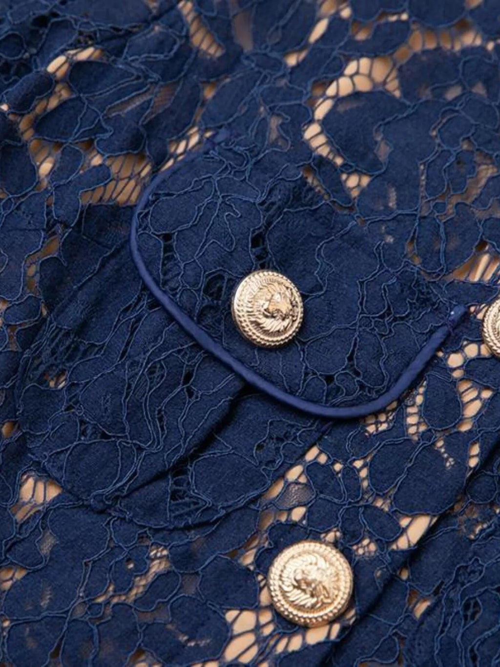Lace Button-Down Midi Dress