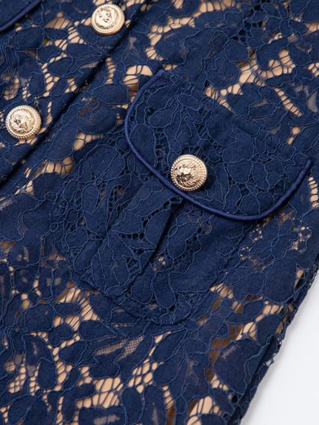 Lace Button-Down Midi Dress